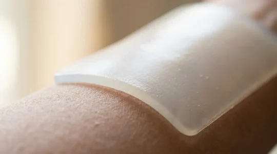 Trattamento cicatrice ipertrofica con cerotto al silicone su pelle