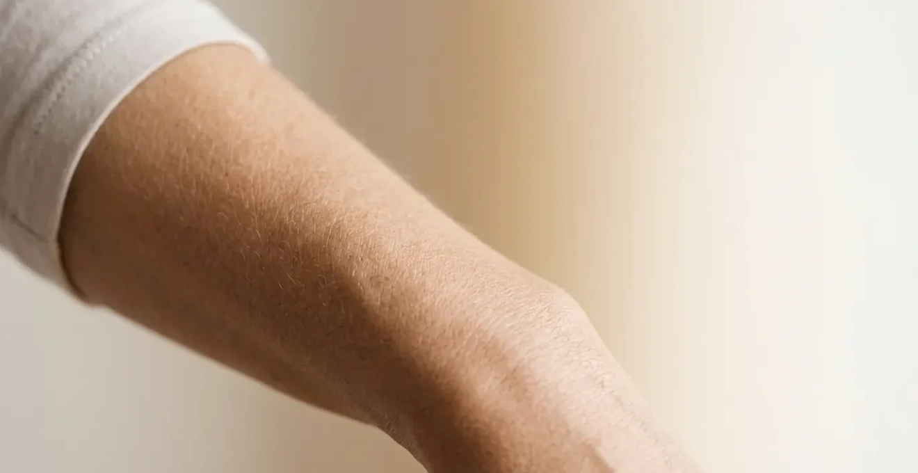 Trattamento medico estetico per il rassodamento della pelle di ginocchia e braccia con tecnologie non invasive