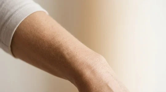 Trattamento medico estetico per il rassodamento della pelle di ginocchia e braccia con tecnologie non invasive