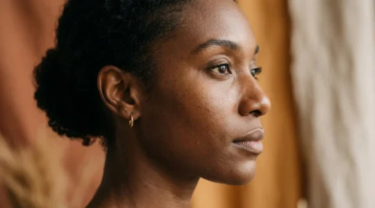 Profilo armonico che integra caratteristiche etniche naturali con raffinamento estetico del naso