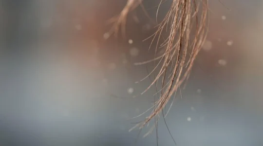 Illustrazione concettuale che rappresenta l'impatto dello stress sui follicoli piliferi e il ciclo di vita dei capelli