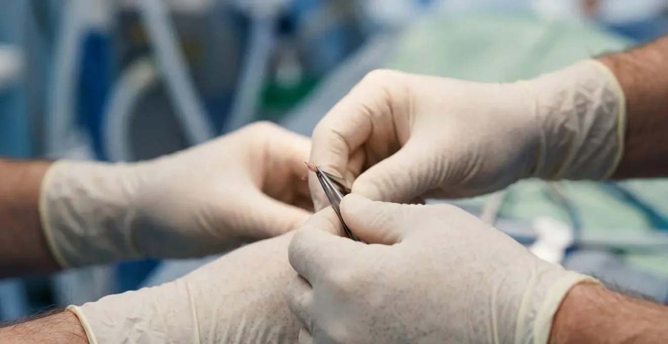 Dettaglio macro di mani delicate che applicano trattamento non invasivo di splinting su un orecchio di neonato, alternativa alla chirurgia.