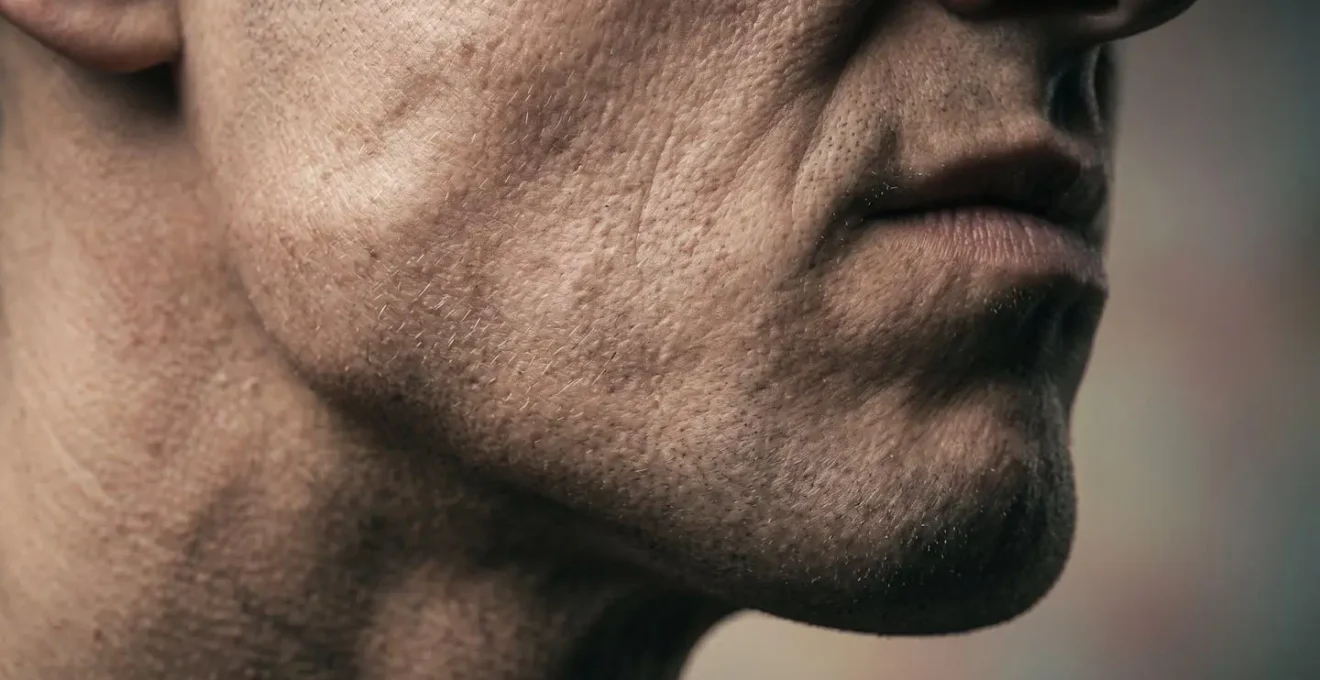 Immagine macro che mostra la tensione muscolare nella zona mandibolare e l'effetto del bruxismo sui lineamenti del viso